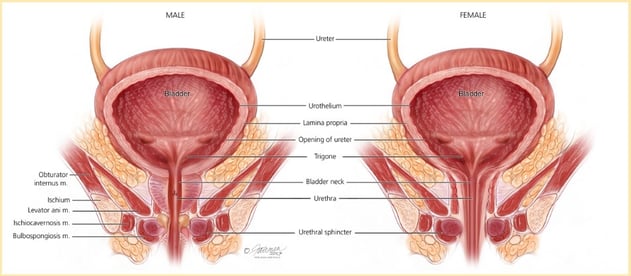 emsella2