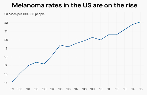 melanoma